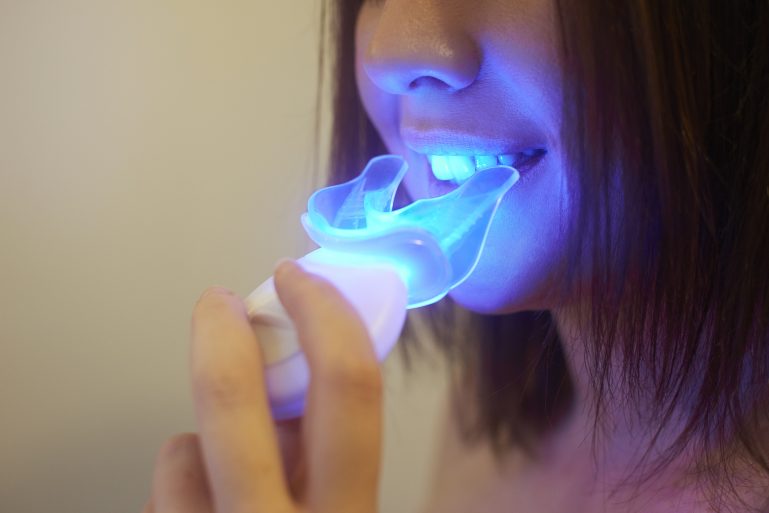 Gouttière pour blanchir les dents avec lampe led