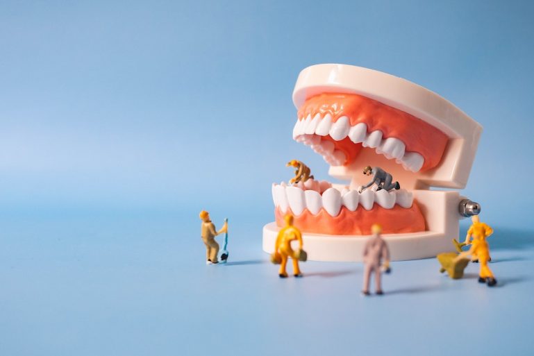 Des ouvriers miniature s'affairent sur des mâchoires en résine. 