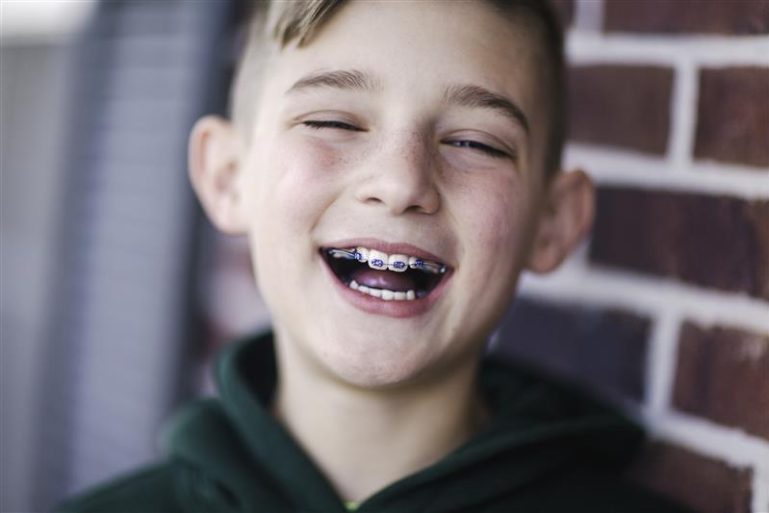 Un enfant avec un appareil dentaire