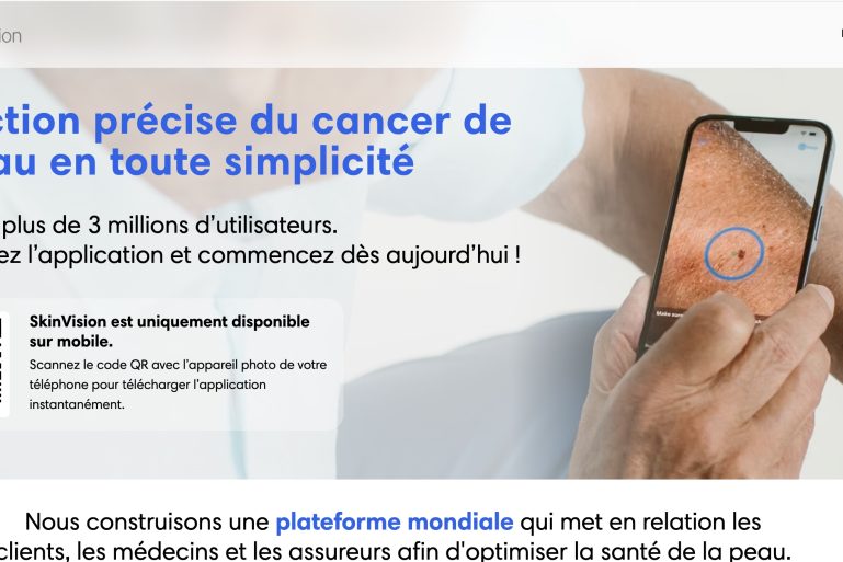 Une personne regarde un grain de beauté avec un smartphone